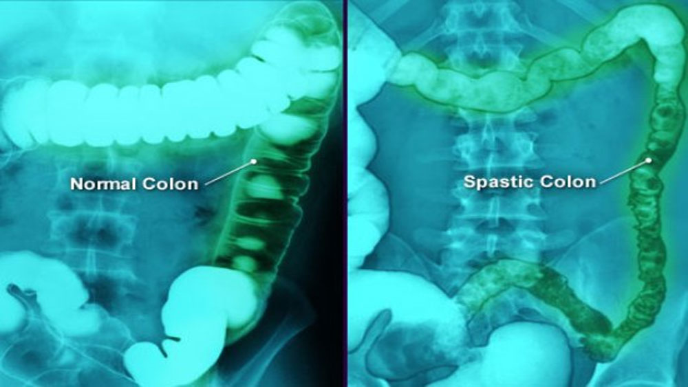 {keywords} {keywords}