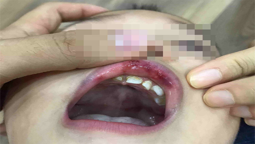 {keywords} {keywords}