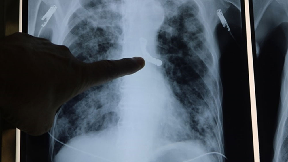 {keywords} {keywords}