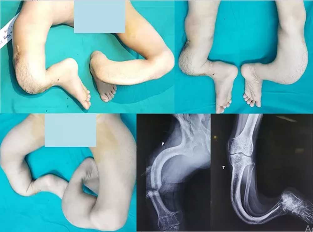 {keywords} {keywords}