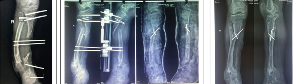 {keywords} {keywords}