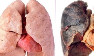 Hơn 230 người Việt tử vong mỗi ngày vì thuốc lá