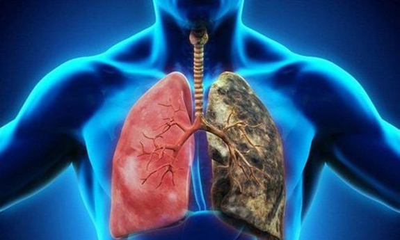 Thuốc lào là gì và có hại không?