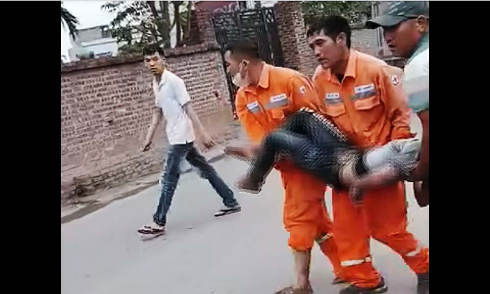 Thị xã Việt Yên: Học sinh thả diều gây chập điện cao áp, bị bỏng nặng