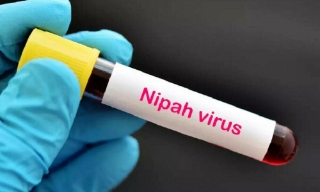 Bộ Y tế hướng dẫn chẩn đoán và điều trị bệnh do virus Nipah