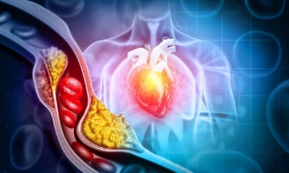 Ô nhiễm tiếng ồn ban đêm ảnh hưởng đến sức khỏe tim mạch