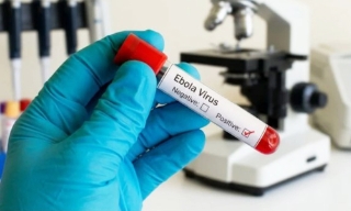 Bộ Y tế chỉ đạo khẩn ứng phó với bệnh do virus Ebola