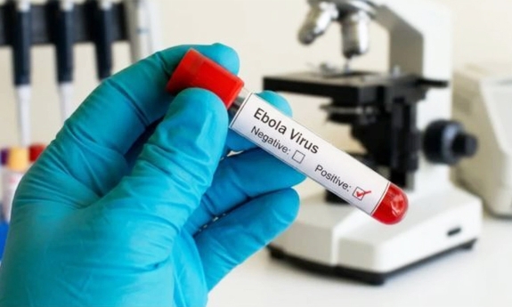 Bộ Y tế chỉ đạo khẩn ứng phó với bệnh do virus Ebola