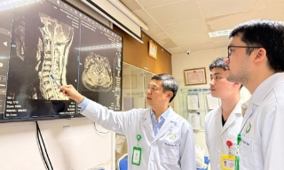 Người bệnh từ Anh trở về Việt Nam điều trị thành công hẹp ống sống cổ nặng