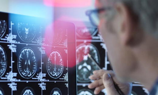 Nga thành công thử nghiệm sơ bộ chiến lược mới điều trị bệnh Alzheimer